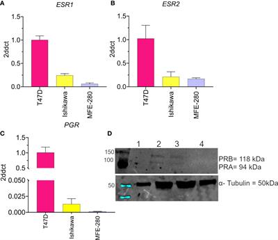 Invasiveness of endometrial cancer cell lines is potentiated by estradiol and blocked by a traditional medicine Guizhi Fuling at clinically relevant doses